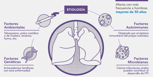 Factores de riesgo de la fibrosis pulmonar idiopática