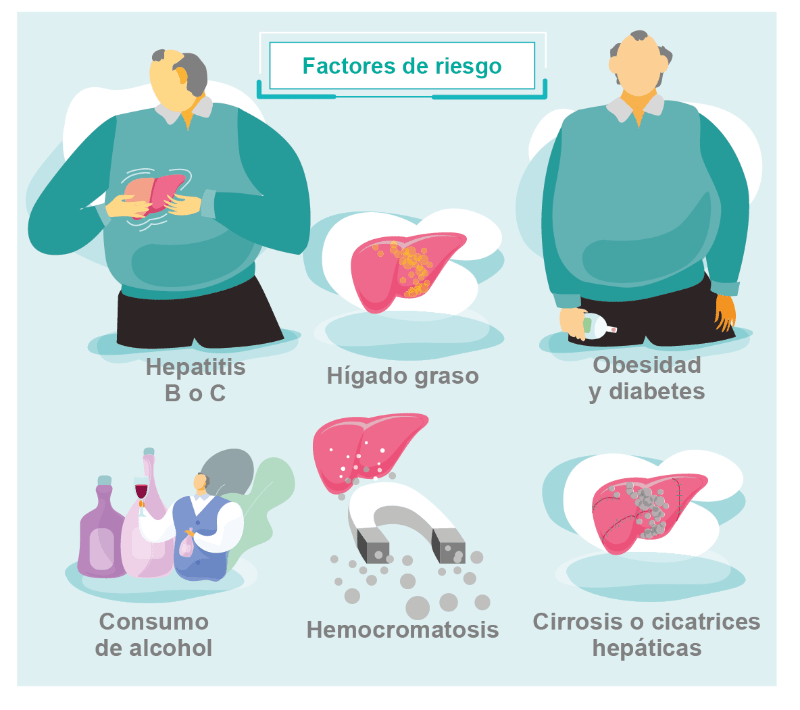 Factores de riesgo cáncer de hígado
