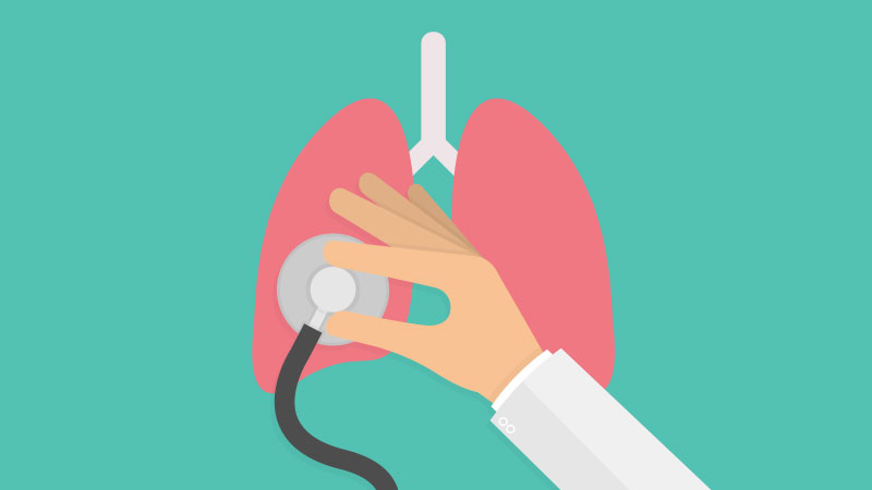 Aspectos clave del cáncer de pulmon