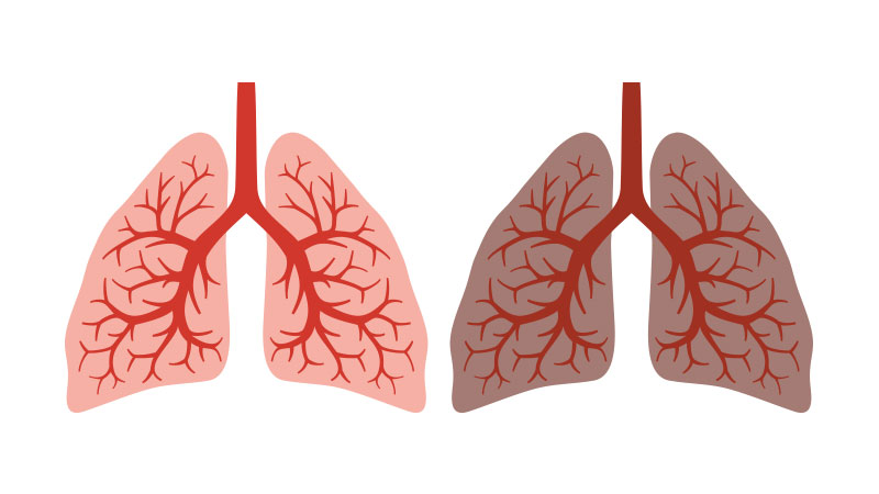 decálogo del cáncer de pulmón