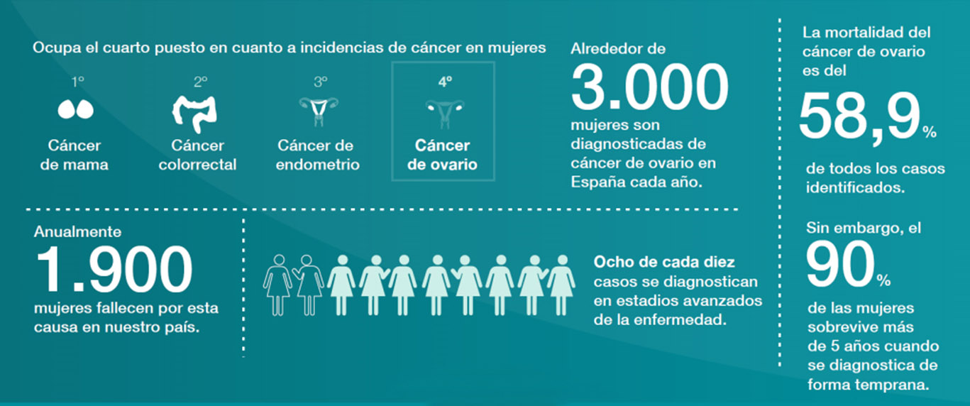 Infografía sobre el cáncer de ovario.